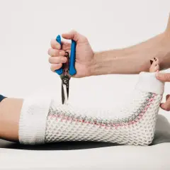 Lekarz zdejmuje lekki gips z nogi pacjenta. Zastanawiasz się, ile kosztuje lekki gips w szpitalu?