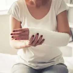 Kobieta z ręką w gipsie, zastanawia się, co zrobić, żeby gips szybko nie stwardniał.