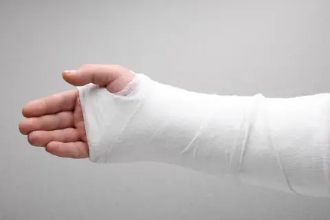 Kiedy gips jest za luźny? Objawy i ryzyko dla zdrowia