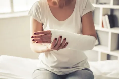 Kobieta z ręką w gipsie, zastanawia się, co zrobić, żeby gips szybko nie stwardniał.