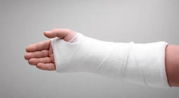 Kiedy gips jest za luźny? Objawy i ryzyko dla zdrowia