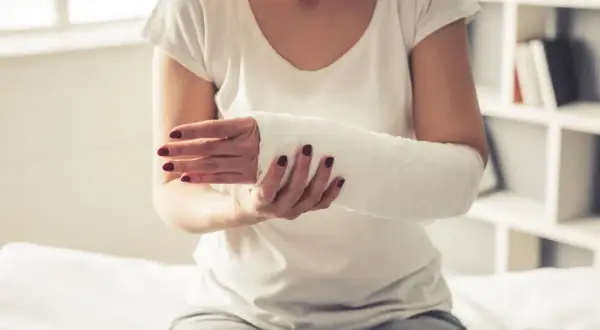 Kobieta z ręką w gipsie, zastanawia się, co zrobić, żeby gips szybko nie stwardniał.