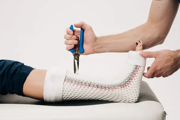 Lekarz zdejmuje lekki gips z nogi pacjenta. Zastanawiasz się, ile kosztuje lekki gips w szpitalu?